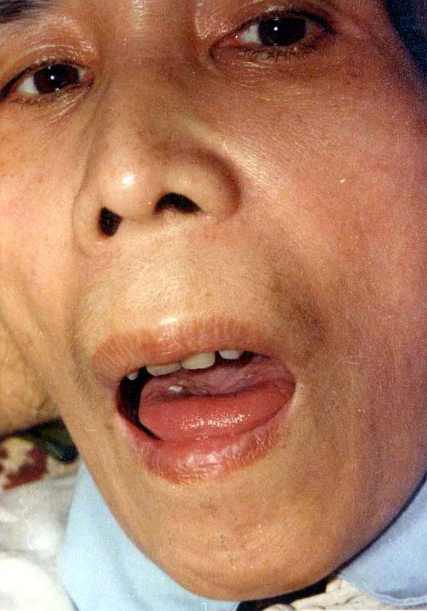 中医望神之少神