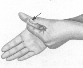 风湿病按摩部位图解