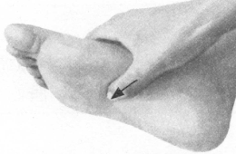 冠心病按摩部位图解