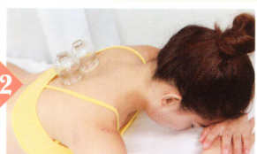 疲劳综合征拔罐部位图解