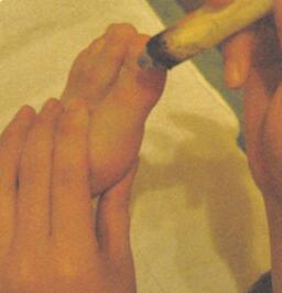 崩漏艾灸哪个部位图解