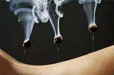 腹泻伤脾胃 针灸治疗选申脉