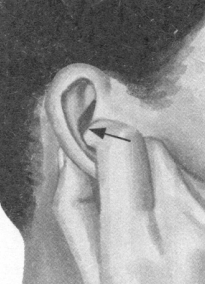 肥胖症按摩部位图解