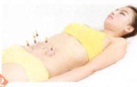 瘦身降脂拔罐部位图解