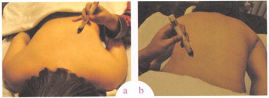 男性不育症艾灸哪个部位图解