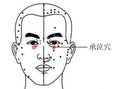 针灸治疗溢泪症