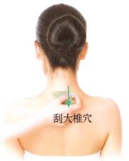 面颊痤疮刮痧部位图解