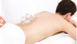 慢性肾炎拔罐部位图解