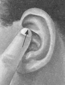 咳喘病按摩部位图解