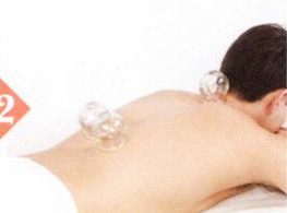 阴囊潮湿拔罐部位图解