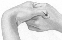 肥胖症按摩部位图解