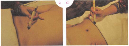 男性不育症艾灸哪个部位图解