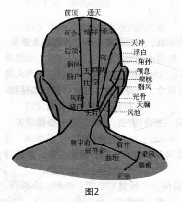 失眠病磁圆梅针疗法