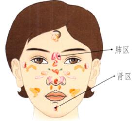 雀斑刮痧部位图解