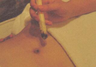 胃脘不适艾灸哪个部位图解