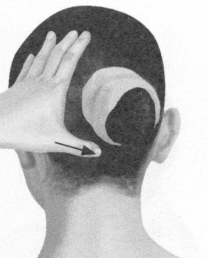 颈椎病按摩部位图解