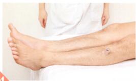 低血压拔罐部位图解