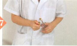 梅尼埃综合征拔罐部位图解