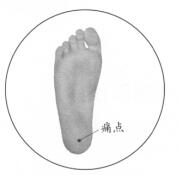 足跟痛按摩部位图解