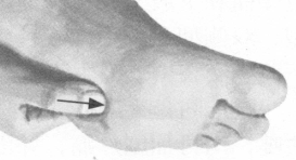 颈椎病按摩部位图解