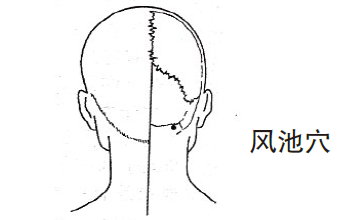 针灸穴位治疗各类痛证
