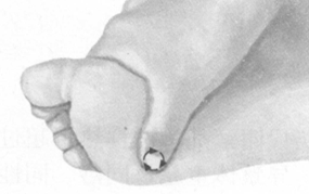 更年期综合征按摩部位图解