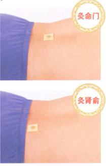 阳痿艾灸哪个部位图解