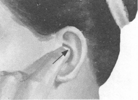 高血压按摩部位图解