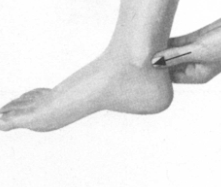 冠心病按摩部位图解