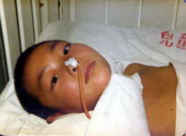 中医望色之面色黑红