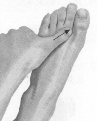 失眠症按摩部位图解