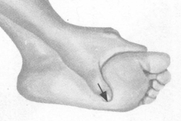 胃肠炎按摩部位图解