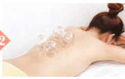 胃痉挛拔罐部位图解