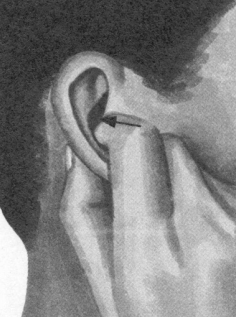 耳鸣-耳痛按摩部位图解