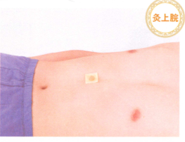 呕吐艾灸哪个部位图解