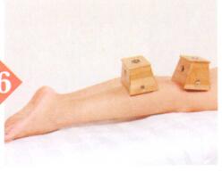 膝关节炎艾灸哪个部位图解