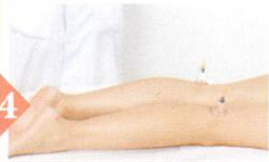 急性腰扭伤拔罐部位图解