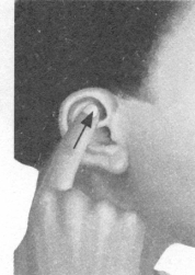 高脂血症按摩部位图解