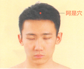 头痛艾灸哪个部位图解