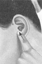 高脂血症按摩部位图解