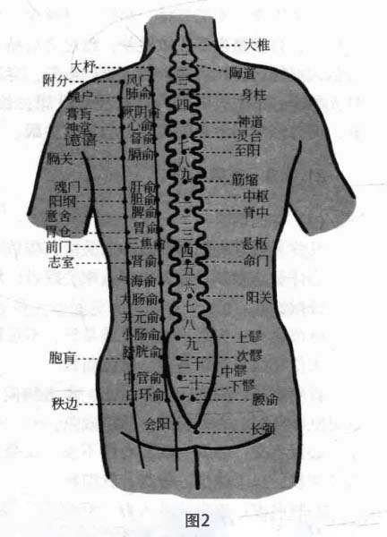 失眠病磁圆梅针疗法