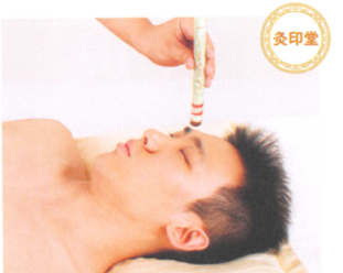 鼻炎艾灸哪个部位图解