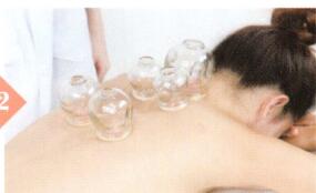 肺炎拔罐部位图解