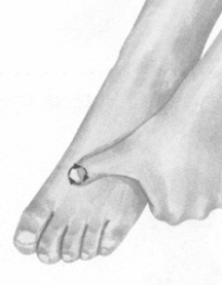 更年期综合征按摩部位图解