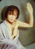 可见经络现象的研究