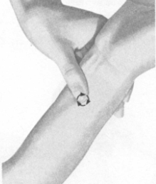 颈椎病按摩部位图解