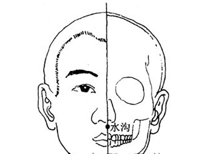 针刺水沟治尾骨痛