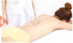 鼻炎拔罐部位图解