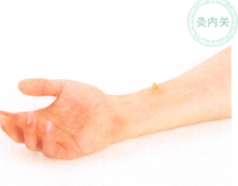 冠心病艾灸哪个部位图解