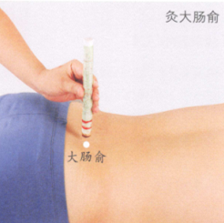 腰椎间盘突出艾灸哪个部位图解